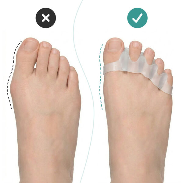 Alternative view of OrthoRelax® – Gel separator za prste (2 separatora)